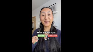 What pimples you SHOULD and SHOULDN’T pop [upl. by Makell506]