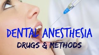 Dental Anesthesia [upl. by Acinorev]