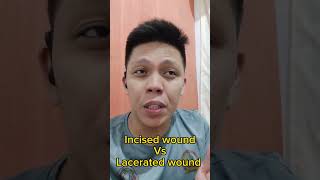 Incised wound Vs Lacerated wound [upl. by Lorenza]