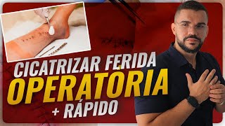 COMO CICATRIZAR UMA FERIDA OPERATÓRIA MAIS RÁPIDO [upl. by Aoniak]