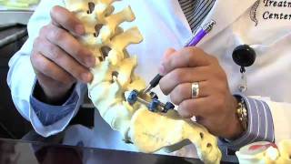 Surgical Procedures  Lumbar Laminectomy amp Discectomy [upl. by Giwdul]