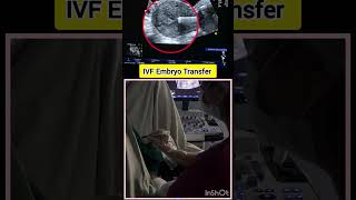 IVF Embryo Transfer IVF treatment for pregnancy by Dr Rakshita Malik ivfdoctor ivfspecialist [upl. by Rodgiva]