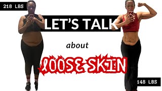 The TRUTH About Loose Skin After Weight Loss  Before amp After [upl. by Christianity]