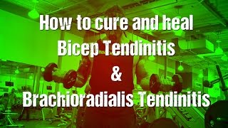 Bicep tendonitis amp brachioradialisforearm tendinitis [upl. by Kcirde859]