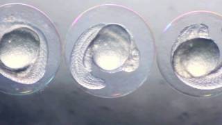 Zebrafish Embryos [upl. by Gardell]