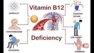 Top 6 Vitamin B12 DEFICIENCY Symptoms YOU NEED TO KNOW [upl. by Pearman]