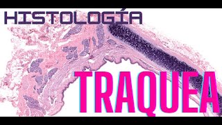 Histología de Tráquea [upl. by Elohc]