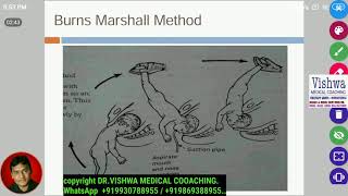 Burn marshalls maneuver for breech presentation BY DRVISHWA MEDICAL COACHING WHATSAPP 919930788955 [upl. by Rutherford448]