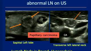 Thyroid Ultrasound Course [upl. by Bevin349]