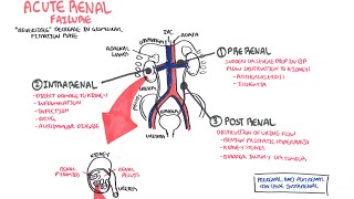 Acute Renal Failure [upl. by Dinnage]