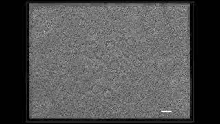 Intranuclear Herpesvirus Capsids Revealed by CryoFIBET [upl. by Anatollo]