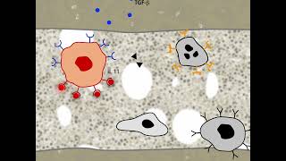 Vicious cycle in the generation of osteoclastic bone metastases in mammary cancer HD [upl. by Hplodnar288]