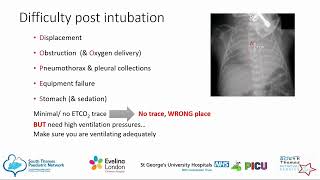 Paediatric Team  Stabilisation and Management of the Critically Unwell Child [upl. by Eidak]