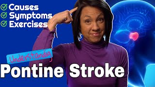 Pontine Stroke Causes symptoms and best exercises [upl. by Arytas]