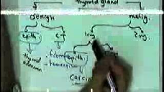 SYSTEMIC PATHOLOGY endocrine 2 DR SAMEH GHAZY [upl. by Anitrak625]