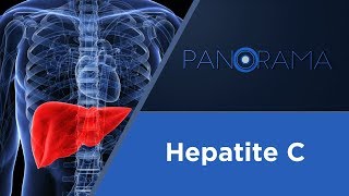 Panorama  Hepatite C  16112017 [upl. by Garv197]