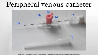 Peripheral venous catheter [upl. by Hennie]