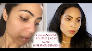 Full Coverage  Acne Scars Hyperpigmentation Color Correcting Makeup Routine [upl. by Adnirual]