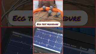 How to perform an ECG shorts medical ecg [upl. by Kauppi]