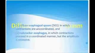 USMLE What you need to know about diffuse esophageal spasme [upl. by Enneirdna]