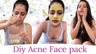 Diy Acne Face pack Urfi javed [upl. by Retxed532]