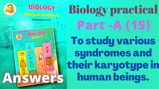 To study various syndromes and their karyotypes in human beings class 12 Biology practical Part A 15 [upl. by Irving]