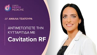 Αντιμετωπίστε την κυτταριτιδα με Cavitation RF [upl. by Esinaej]