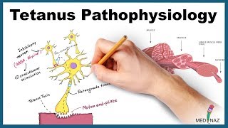 Tetanus Pathophysiology Mechanism of Action [upl. by Anawyt592]