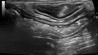 Sonography of ulcerative or granulomatous colitis in a French Bulldog [upl. by Crispin]