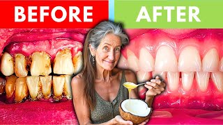 quotFIX YOUR TEETH AFTER 50quot NATURAL Dental Treatment That Actually Works  Barbara ONeill [upl. by Neiviv332]