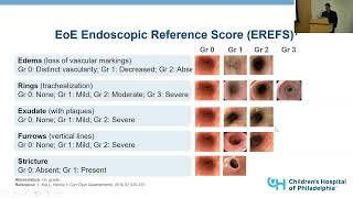 102224 Eosinophilic Esophagitis from Bench to Bedside Translating to Clinical Outcomes [upl. by Trinee]