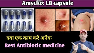 Amyclox LB capsule use dose benefits and side effects full review in hindi [upl. by Lekar]