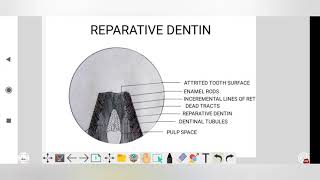 histology of reparative dentin histology lecture dental histology dentin [upl. by Rednaeel]