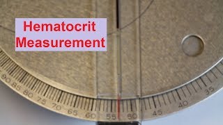 Hematocrit Measurement [upl. by Chiou]