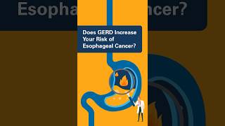 Does GERD Increase Your Risk of Esophageal Cancer [upl. by Taryn]