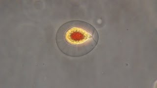 Haematococcus pluvialis the green algae that turn red [upl. by Maible]