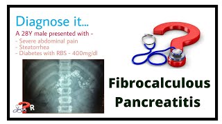 A case of Fibrocalculus pancreatitis [upl. by Erme979]