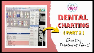 DENTAL CHARTING TX PLANS  PART 2  Charting for Dental Assistants [upl. by Nnaharas673]