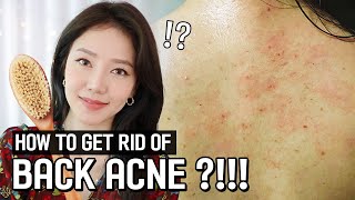 HOW TO GET RID OF BACK ACNE  SHOWER ROUTING FOR BACK ACNE featMEDICUBE [upl. by Nnylcaj333]