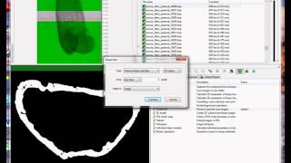 Cortical bone 1 periosteal and endosteal parameters [upl. by Dennet]