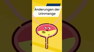 6 Anzeichen von Nierenversagen shorts [upl. by Ybreh]