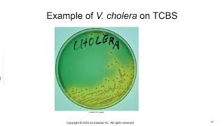 Vibrio Aeromonas and Campylobacter [upl. by Magan779]