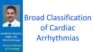 Broad classification of cardiac arrhythmias [upl. by Repohtsirhc703]