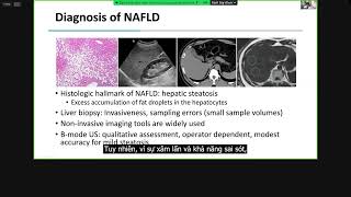 Quantitative Ultrasound QUS for Assessing Hepatic Steatosis [upl. by Oflunra]