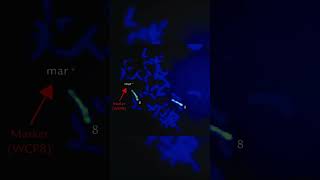 Rare Abnormal Karyotype shorts genetics science [upl. by Adliwa]