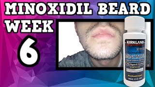 Minoxidil Beard  Week 6  Minoxidil 5 for Beard Growth  FacialFuzzFridays [upl. by Narrad]