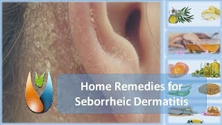 Home Remedies for Seborrheic Dermatitis [upl. by Kieryt]