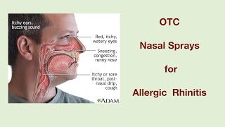 OTC Nasal Sprays for allergic rhinitis [upl. by Anamor]