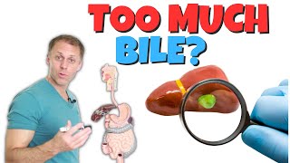 Do I Have Too Much Bile Biliary Hyperkinesia [upl. by Kresic]