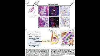 PLAPEGPLA from PolySciTech used in development of celecoxib delivery system for cancer therapy [upl. by Phiona456]